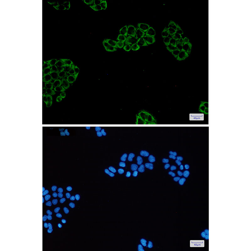 PGM1 Rabbit mAb