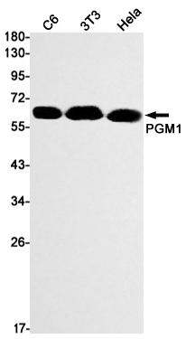 PGM1 Rabbit mAb