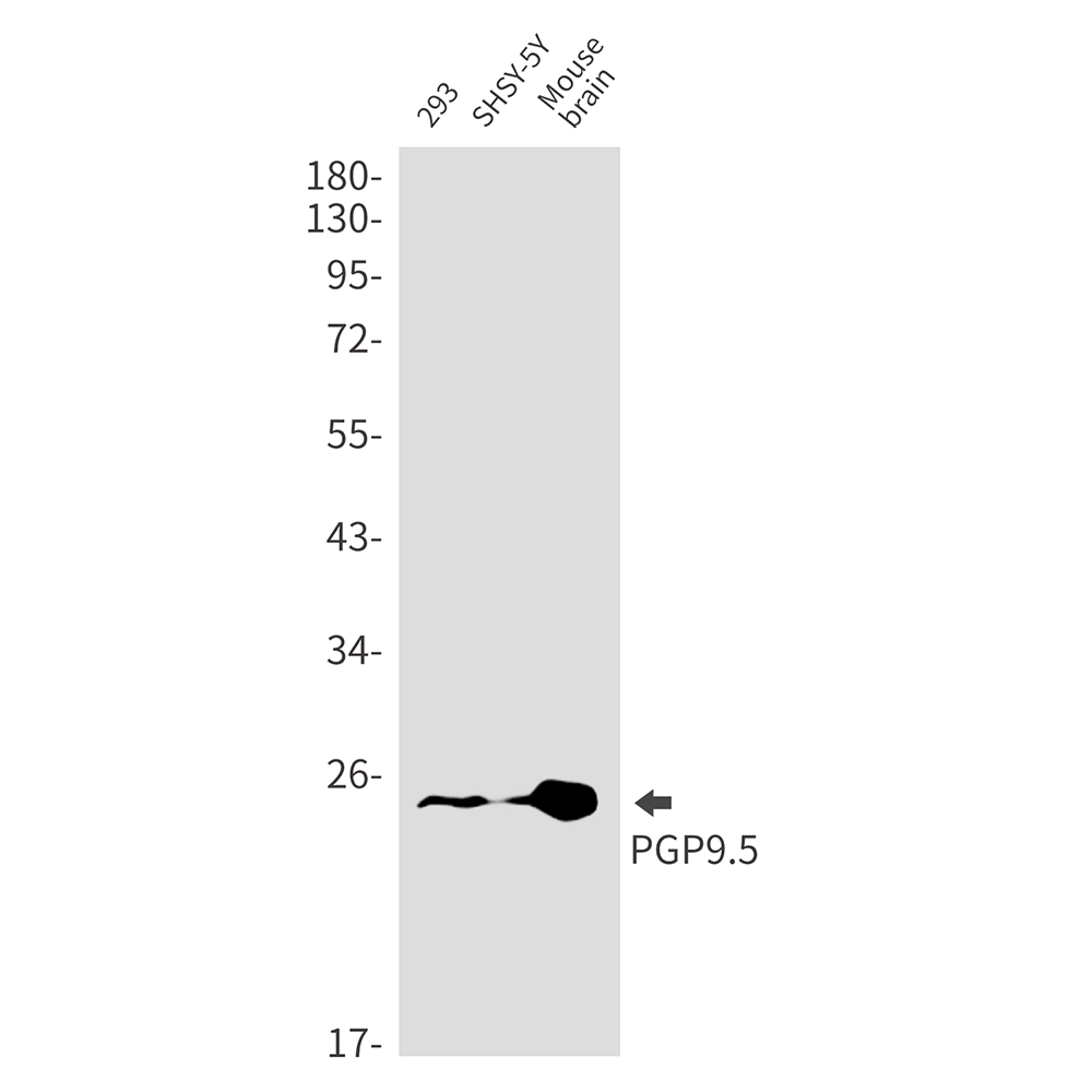 PGP9.5 Rabbit mAb