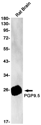 PGP9.5 Rabbit mAb