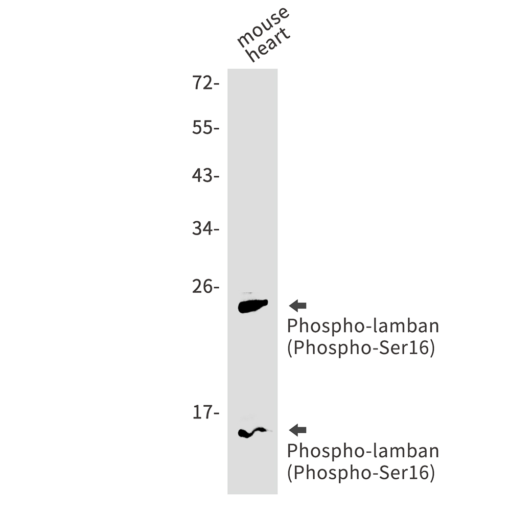 Phospho-Phospholamban (Ser16) Rabbit mAb