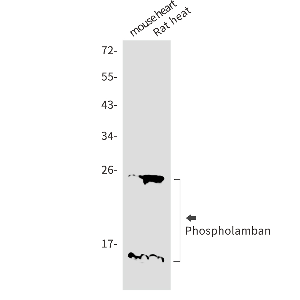 Phospholamban Rabbit mAb