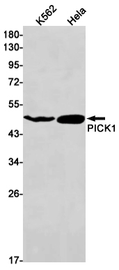 PICK1 Rabbit mAb