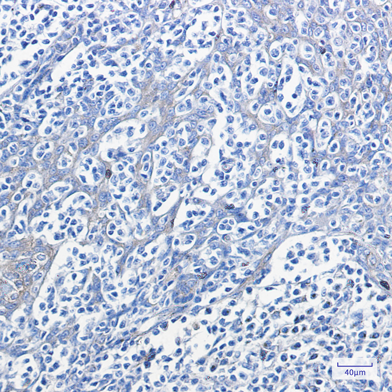 Phospho-PKA RII alpha (Ser99) Rabbit mAb