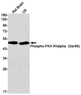 Phospho-PKA RII alpha (Ser99) Rabbit mAb