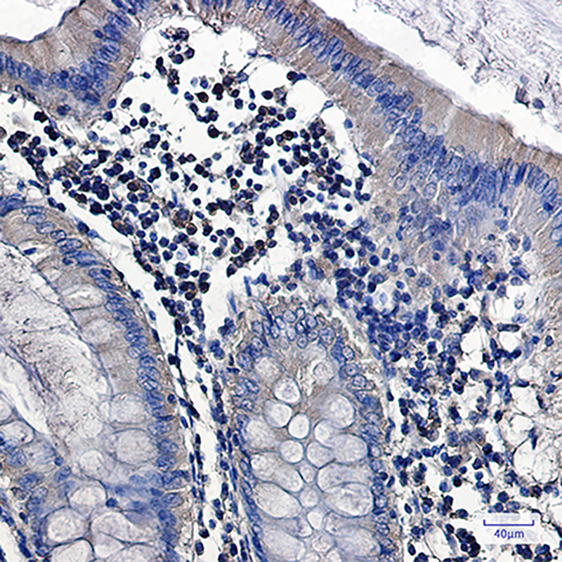 PKC alpha Rabbit mAb