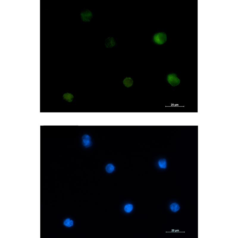 PKC beta 1 Rabbit mAb