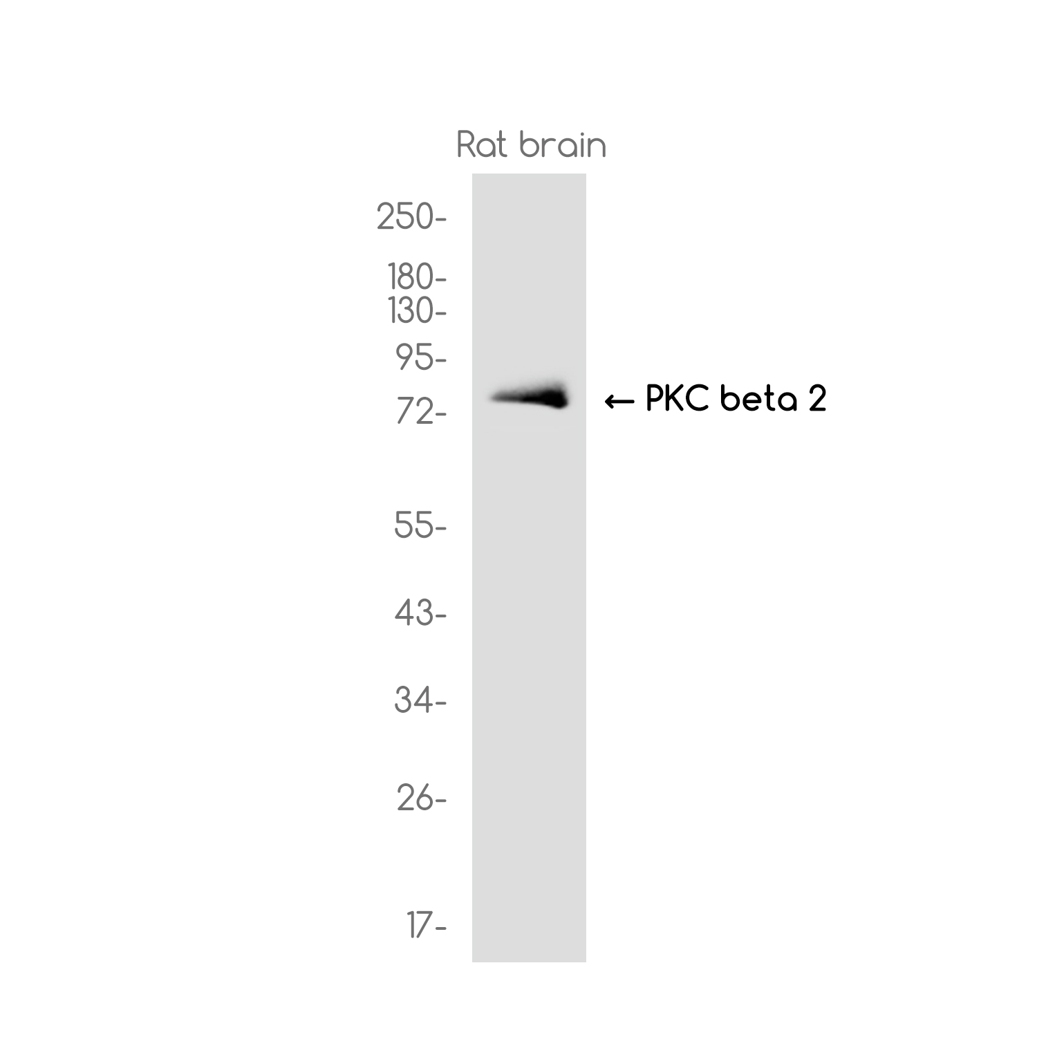 PKC beta 1 Rabbit mAb