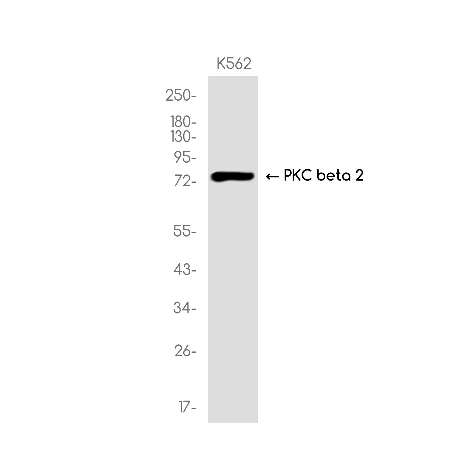 PKC beta 1 Rabbit mAb