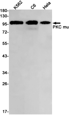 PKD1 Rabbit mAb