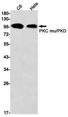 PKD1 Rabbit mAb