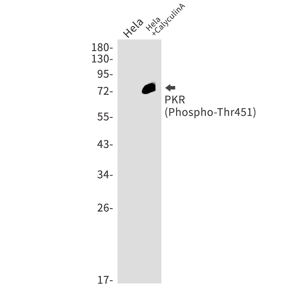 Phospho-PKR (Thr451) Rabbit mAb