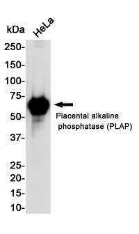 Placental Alkaline Phosphatase Rabbit mAb