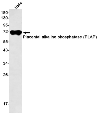 Placental Alkaline Phosphatase Rabbit mAb