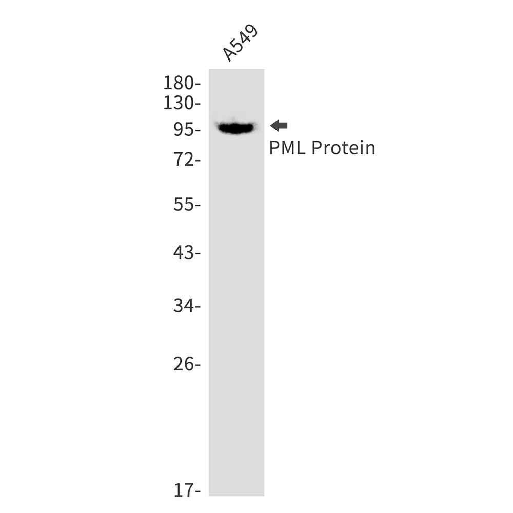 PML Protein Rabbit mAb