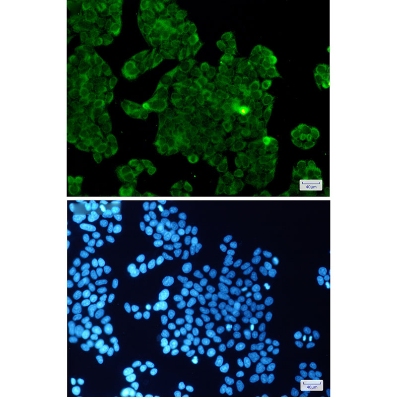 PP1C beta Rabbit mAb