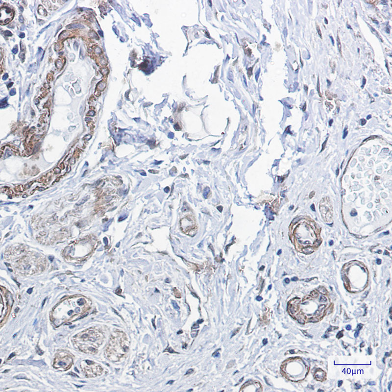 PP1C beta Rabbit mAb