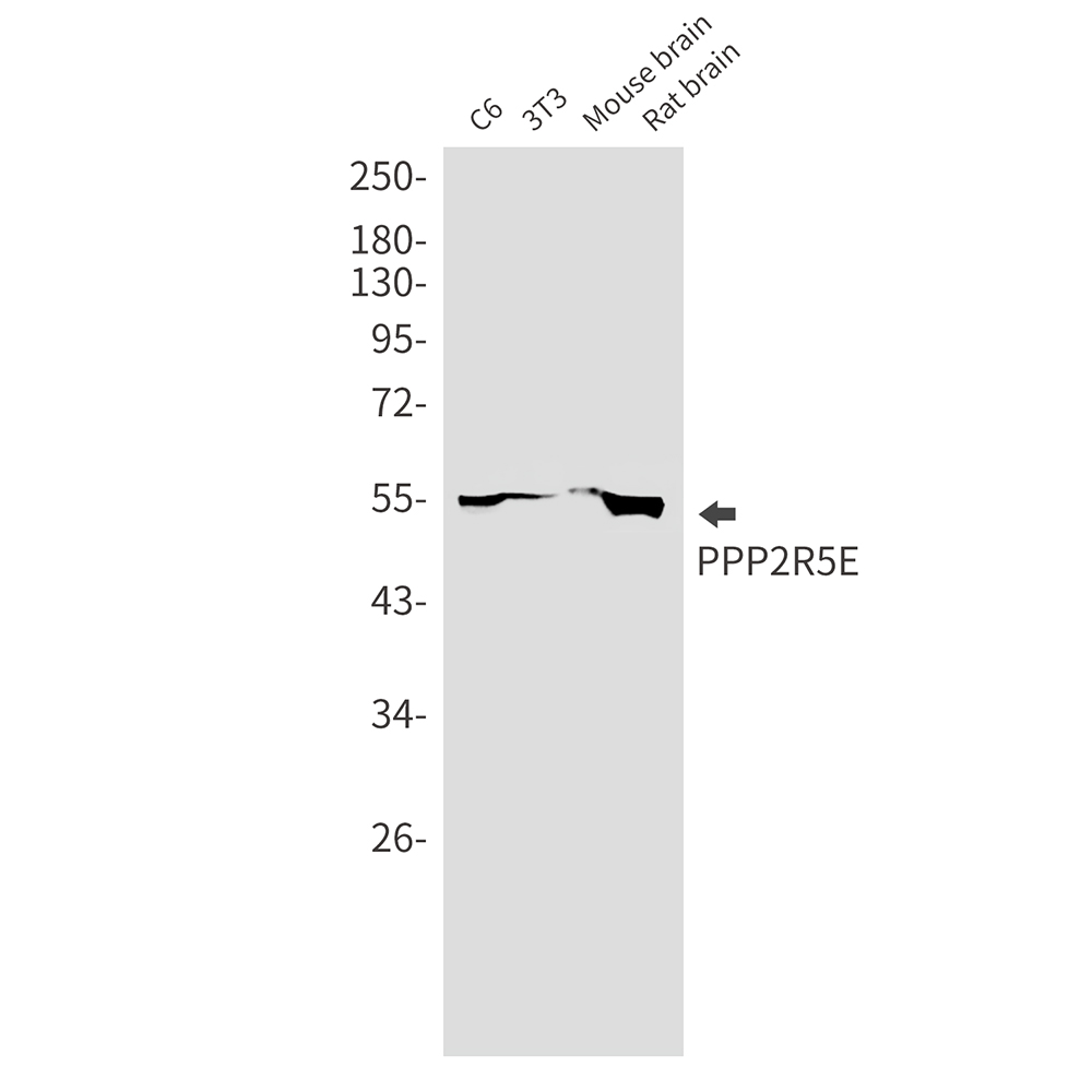 PPP2R5E Rabbit mAb