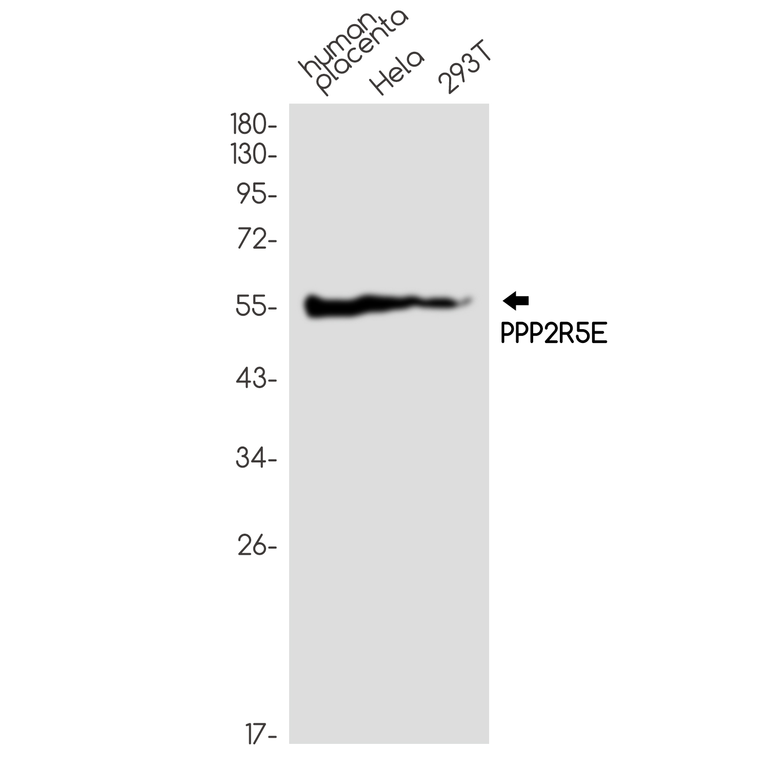 PPP2R5E Rabbit mAb