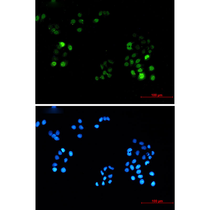 Phospho-PRC1 (Thr481) Rabbit mAb