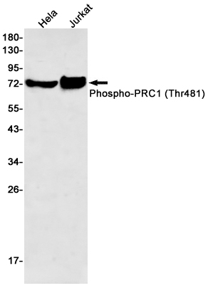 Phospho-PRC1 (Thr481) Rabbit mAb