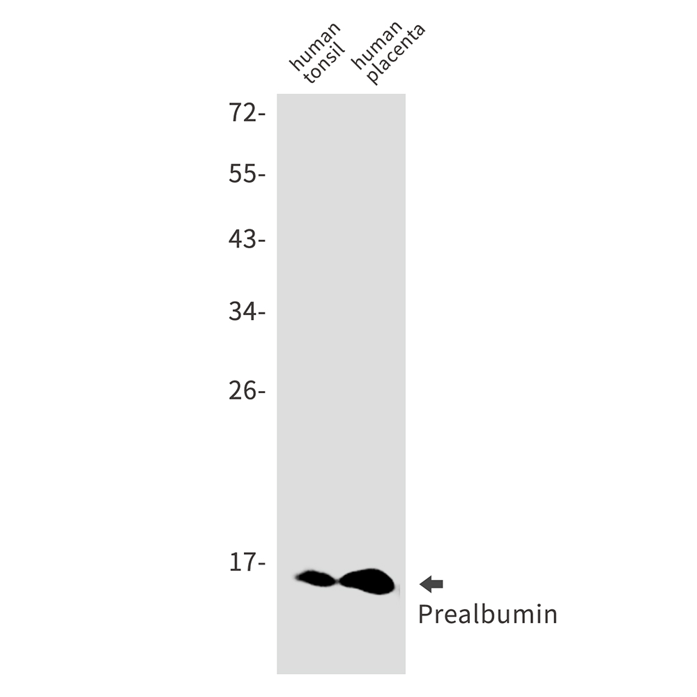 Prealbumin Rabbit mAb