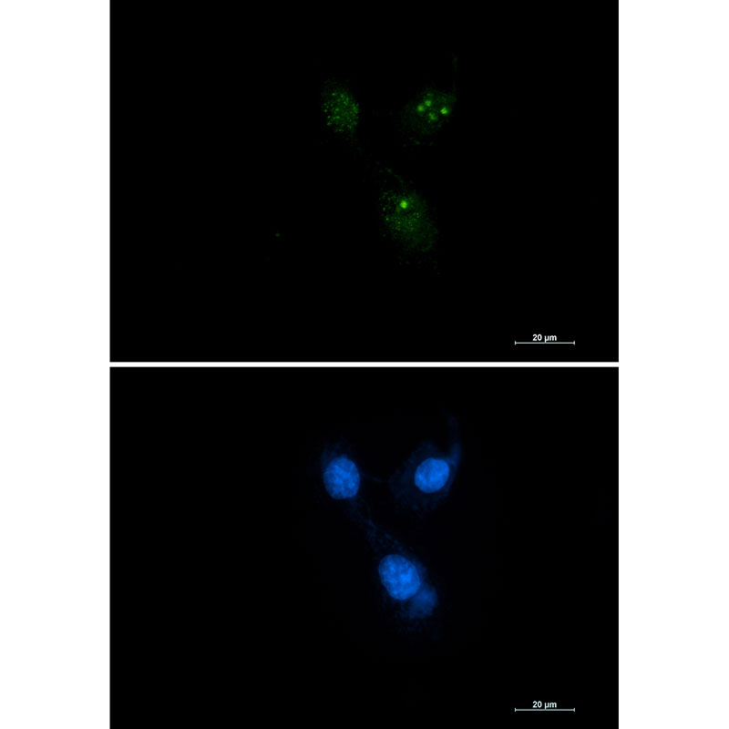 Presenilin 1 Rabbit mAb