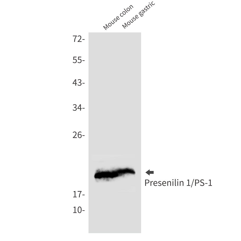 Presenilin 1 Rabbit mAb