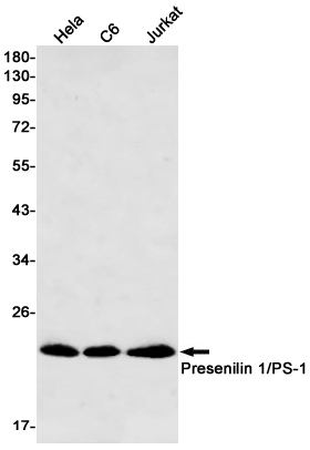 Presenilin 1 Rabbit mAb