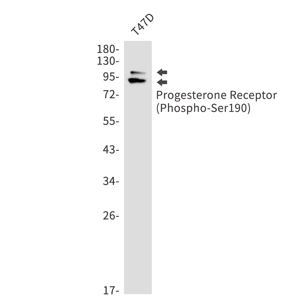 Phospho-Progesterone Receptor (Ser190) Rabbit mAb