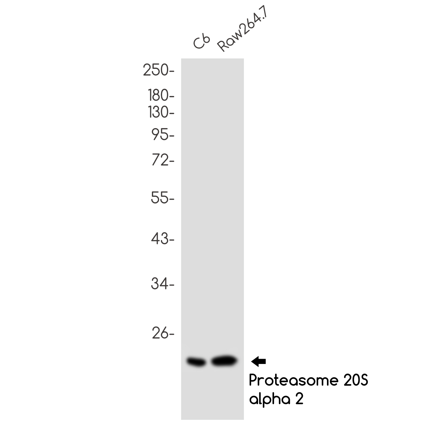 Proteasome beta 9 Rabbit mAb