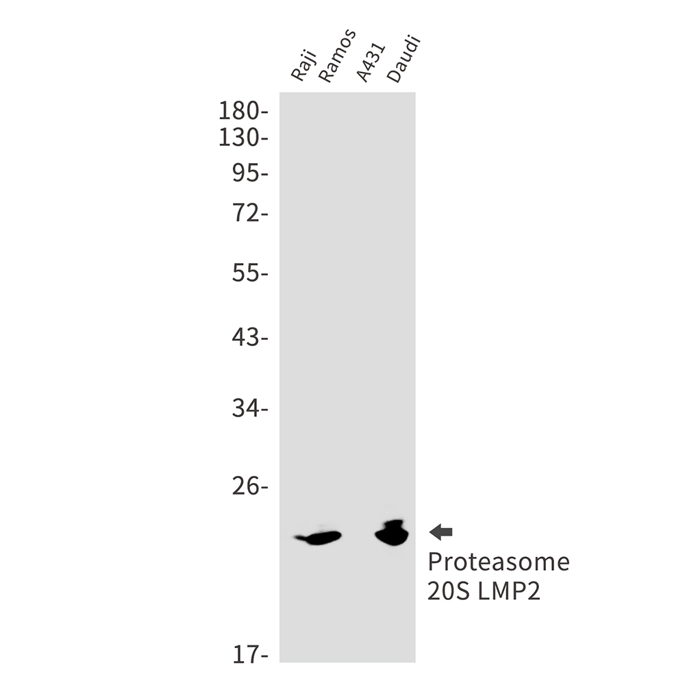 Proteasome beta 9 Rabbit mAb