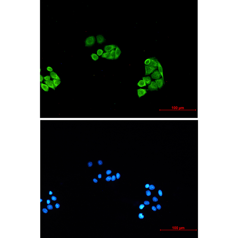 Proteasome alpha 6 Rabbit mAb