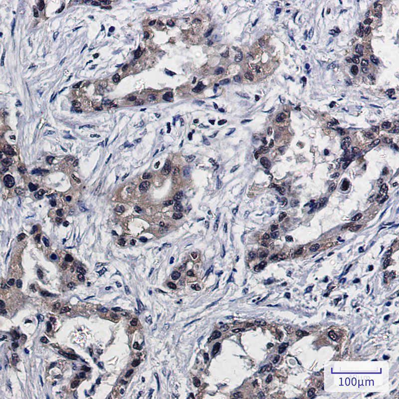 PSMB10 Rabbit mAb