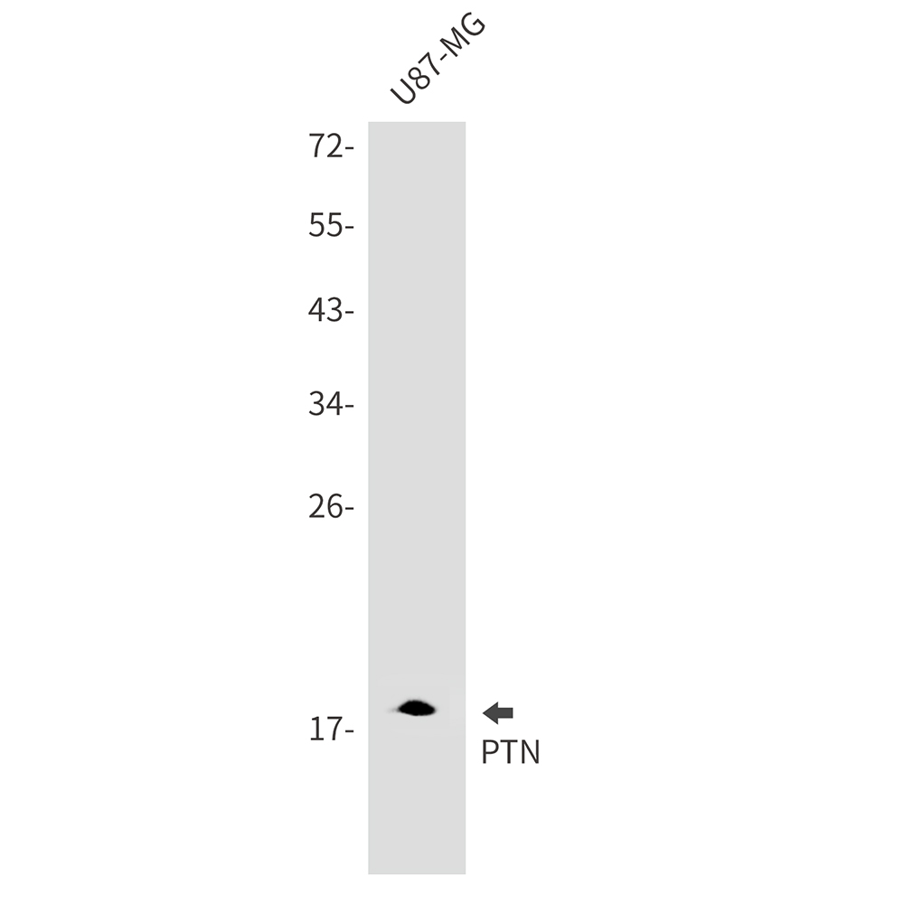 PTN Rabbit mAb