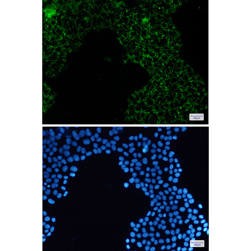 Pyruvate Dehydrogenase E1 alpha Rabbit mAb