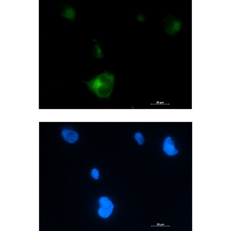 Rab5 Rabbit mAb