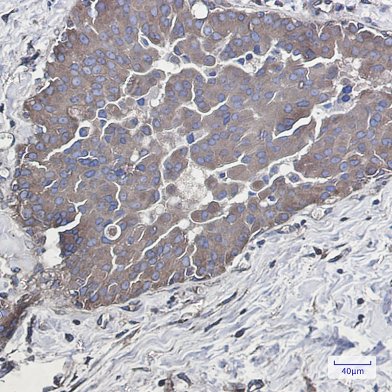 Rab5 Rabbit mAb