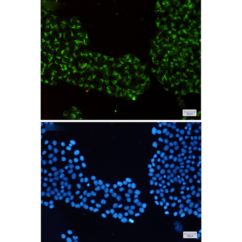 Rab7 Rabbit mAb