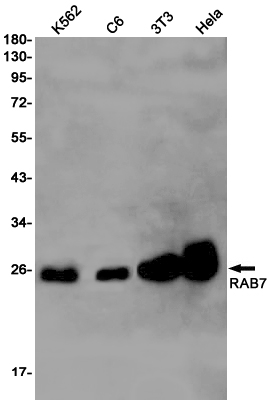 Rab7 Rabbit mAb