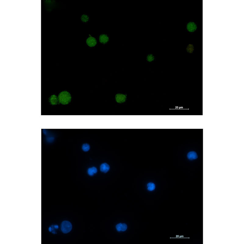 Rad51 Rabbit mAb