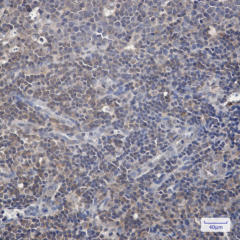 Phospho-Raf1 (Ser259) Rabbit mAb