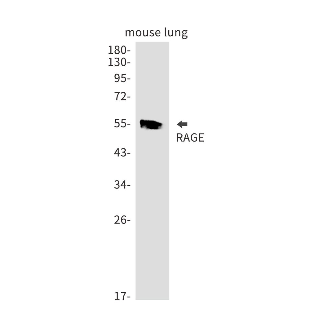 RAGE Rabbit mAb