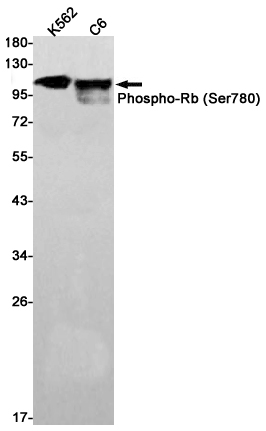 Phospho-Rb (Ser780) Rabbit mAb