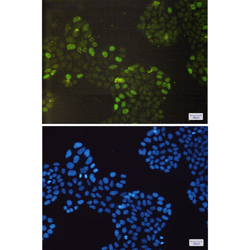 Rb Rabbit mAb