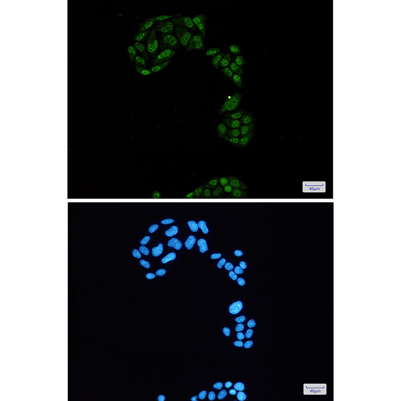 Phospho-Rb2 p130 (Ser952) Rabbit mAb