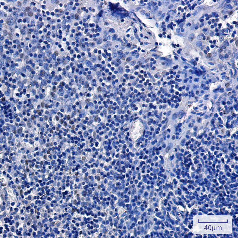 Phospho-Rb2 p130 (Ser952) Rabbit mAb