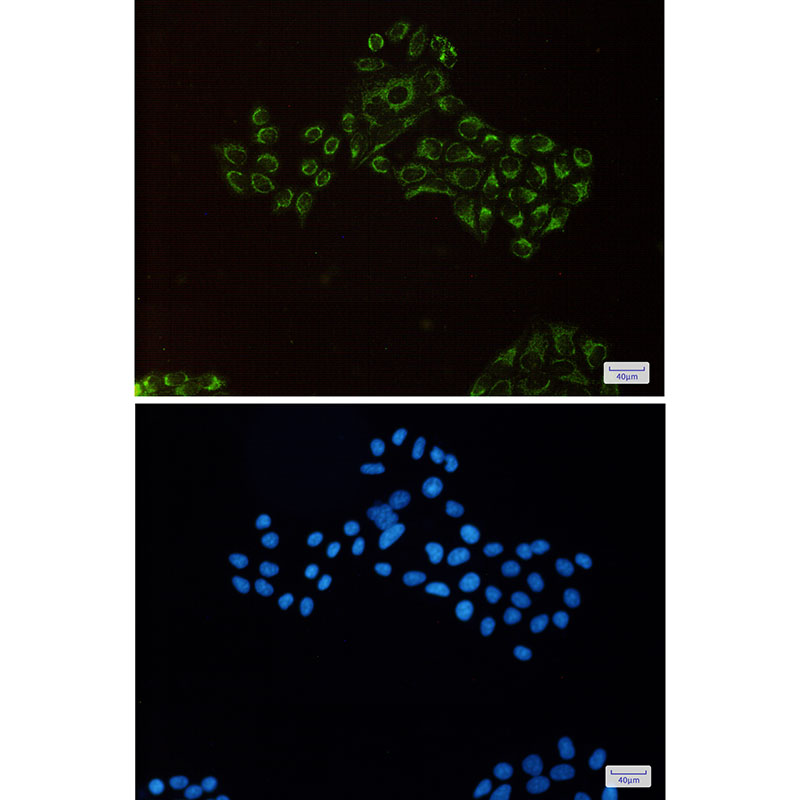 REA Rabbit mAb