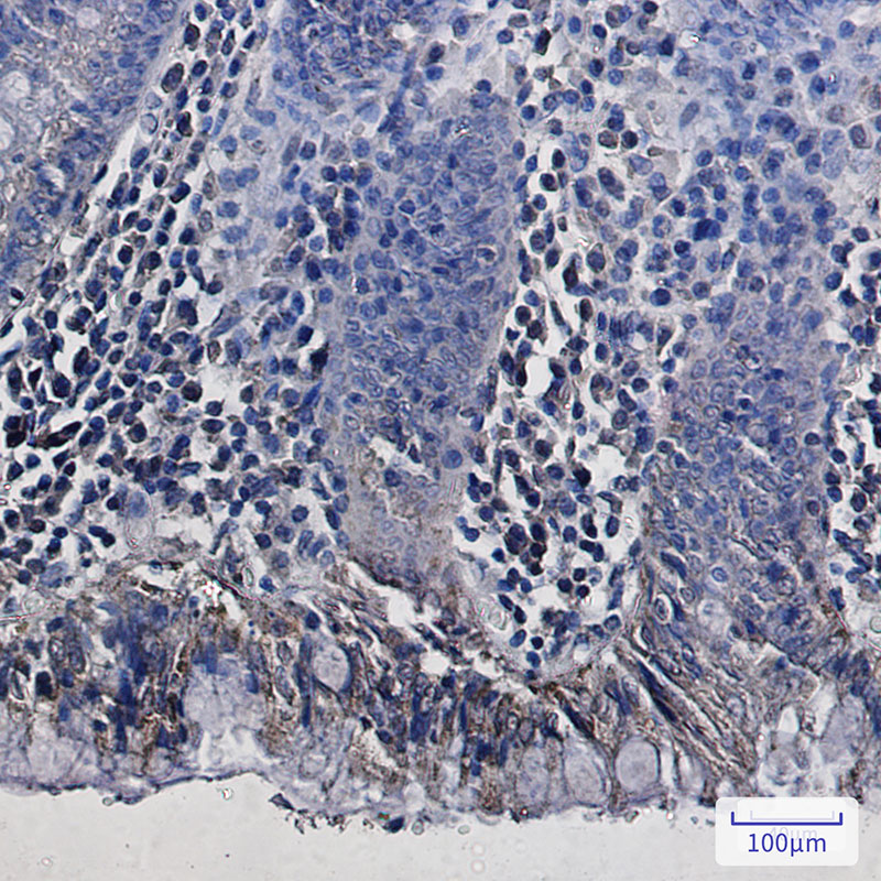 REA Rabbit mAb