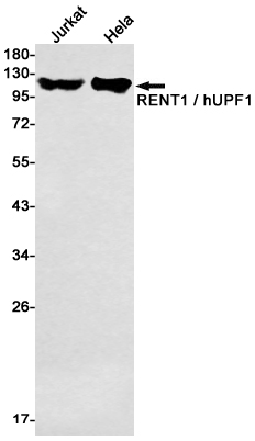 RENT1 Rabbit mAb